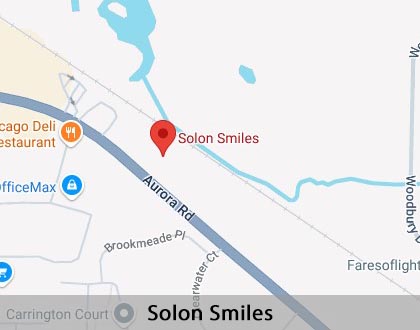 Map image for When Is a Tooth Extraction Necessary in Solon, OH